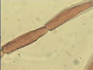 chrysomelae Htype 15.jpg