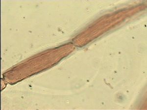 chrysomelae Htype 16.jpg