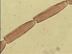 chrysomelae Htype 17.jpg