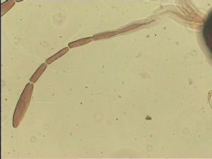 chrysomelae Htype 7.jpg