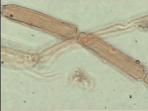 acutiventris 'Type' 11.jpg