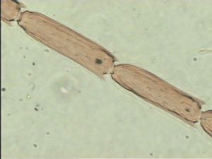 acutiventris 'Type' 12.jpg