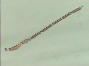 fabarius Pltype 2.jpg