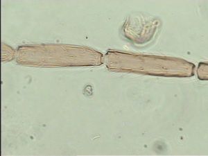 flavitarsis Htype 6.jpg