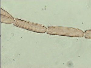 flavitarsis Htype 7.jpg