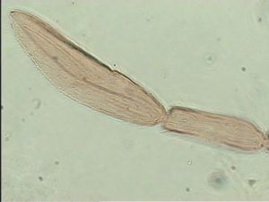 flavitarsis Htype 8.jpg