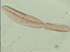 flavitarsis Htype 9.jpg