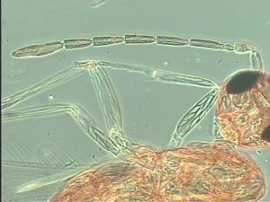 kressbachi Htype 5.jpg