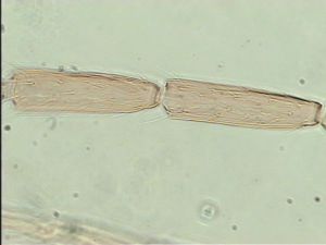 kressbachi Htype 9.jpg