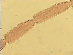 longior Htype 10.jpg