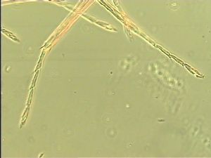 longior Htype 13.jpg