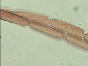 neodistincta Htype 11.jpg