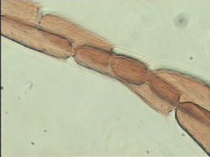 neodistincta Htype 13.jpg