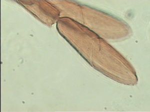 neodistincta Htype 14.jpg