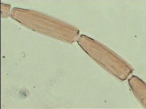 balteata 'Type' 11.jpg