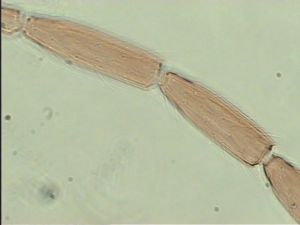 balteata 'Type' 12.jpg