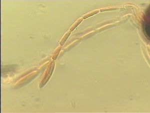 communis Htype 3.jpg