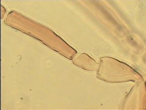 communis Htype 5.jpg