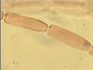 communis Htype 6.jpg