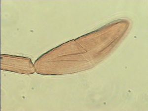 distincta Htype 11.jpg