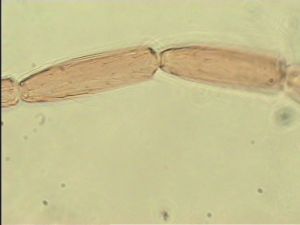 distincta Htype 7.jpg