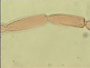 distincta Htype 8.jpg