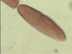 malkwitzi Htype 14.jpg