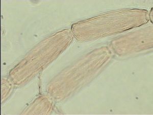 pallidicornis Htype 7.jpg