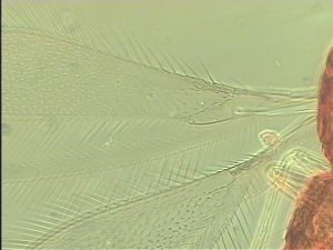 medioacuta Htype 1.jpg