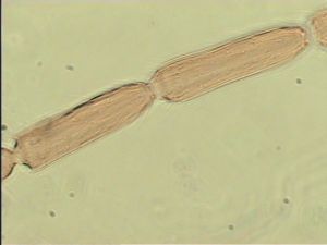 medioacuta Htype 10.jpg