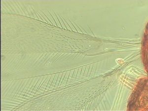 medioacuta Htype 2.jpg