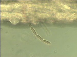 medioacuta Htype 5.jpg