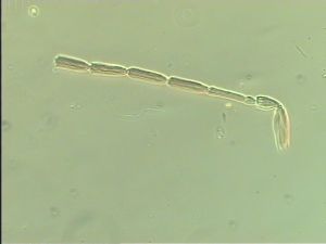 medioacuta Htype 6.jpg