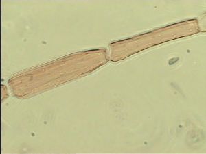 medioacuta Htype 8.jpg