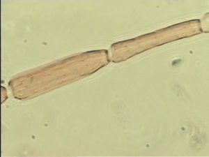 medioacuta Htype 9.jpg