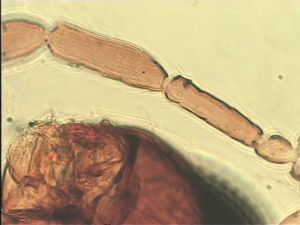 lacensis Htype 9.jpg