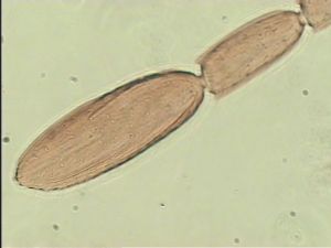 ranalteri 'Type' 11.jpg