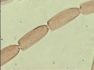 ranalteri 'Type' 9.jpg