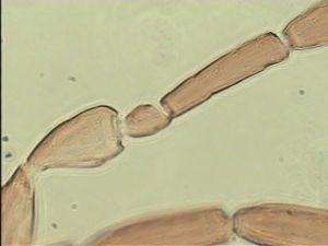 speciosus Htype 7.jpg