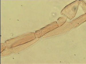 neospecialis Htype 6.jpg