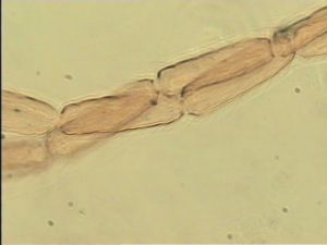 neospecialis Htype 8.jpg