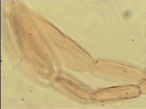 neospecialis Htype 9.jpg