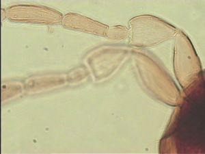 brevitarsis Htype 4.jpg