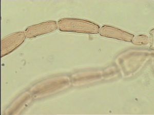 brevitarsis Htype 5.jpg