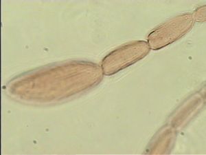 brevitarsis Htype 6.jpg