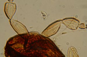 ovipositor 'Type' 1.jpg