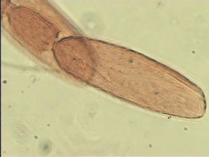 quadraticornis Htype 11.jpg