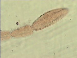 exiguosimilis Htype 10.jpg