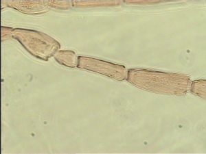 exiguosimilis Htype 6.jpg