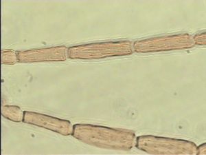exiguosimilis Htype 7.jpg